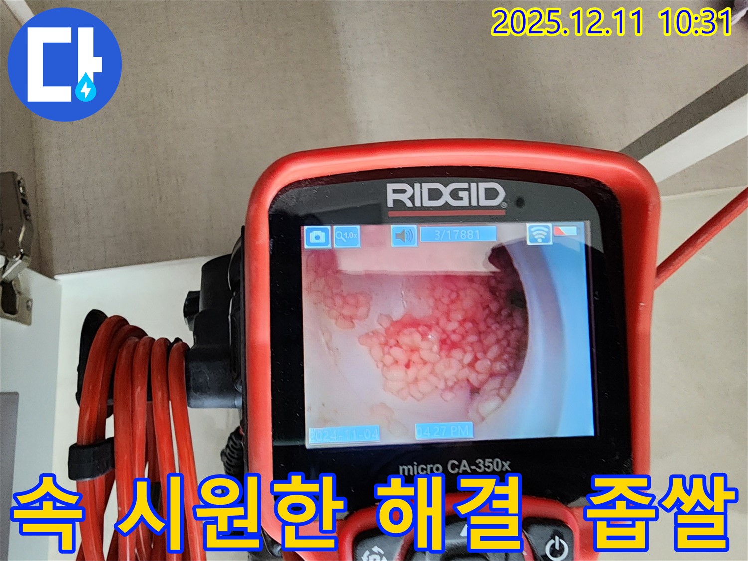 배관 내시경으로 속 시원하게 좁쌀돌기 해결 - 고객 만족 최우선